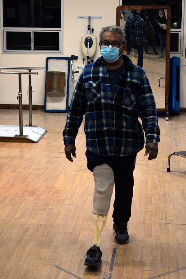 Man walking with prosthetic and mask on