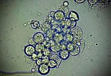 Microscopic view of fungal spores