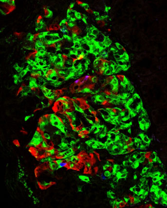 Science image of islet cells generated from human stem cells in the lab transplanted into mice.