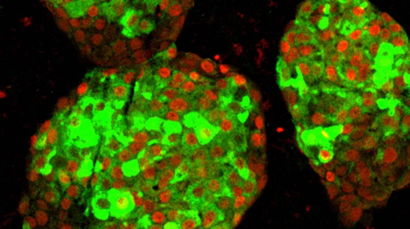 Pancreatic beta cells in a lab dish