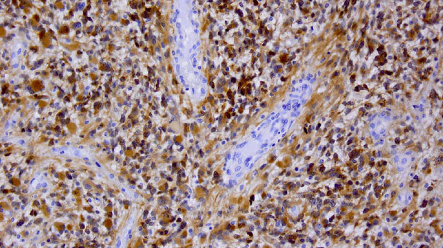 Berkeley Science review brain cancer treatment