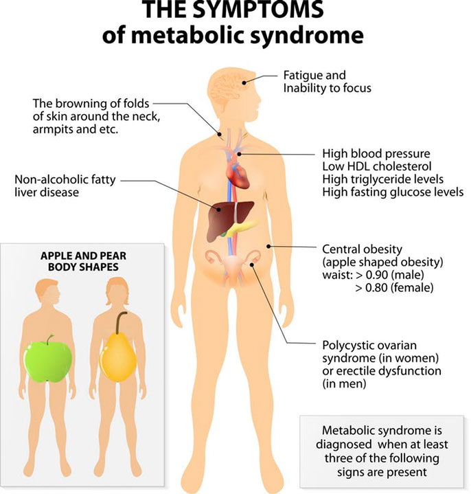 Symptoms of metabolic syndrome