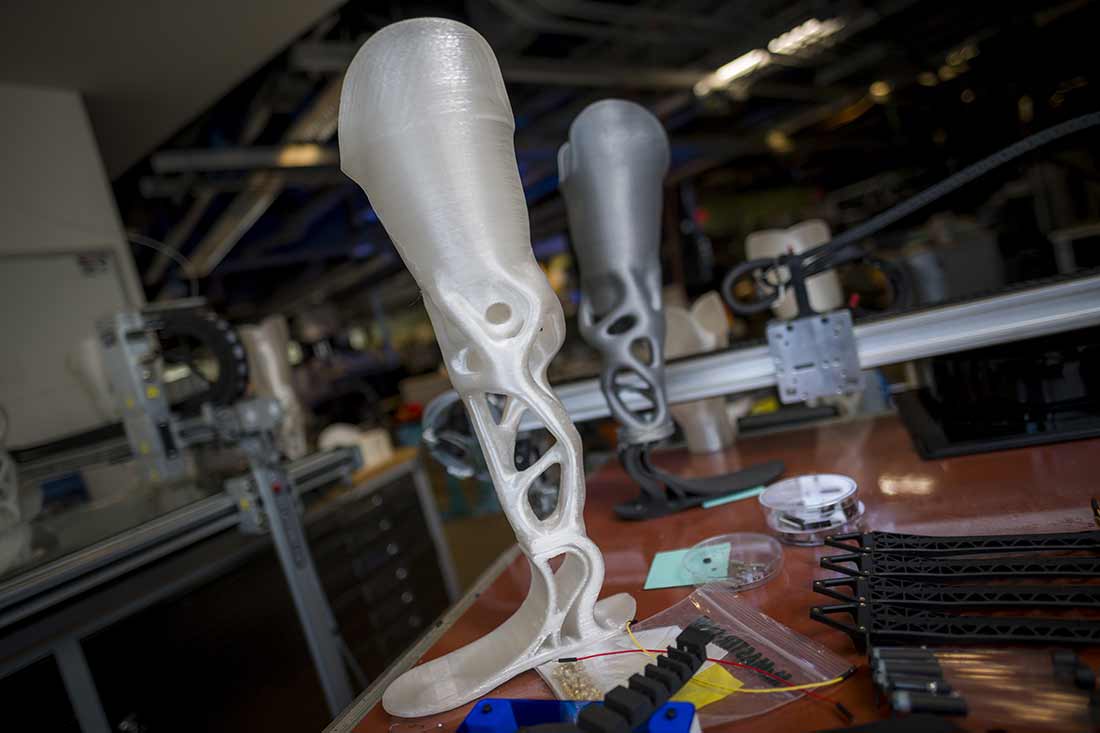3D-printed prosthesis