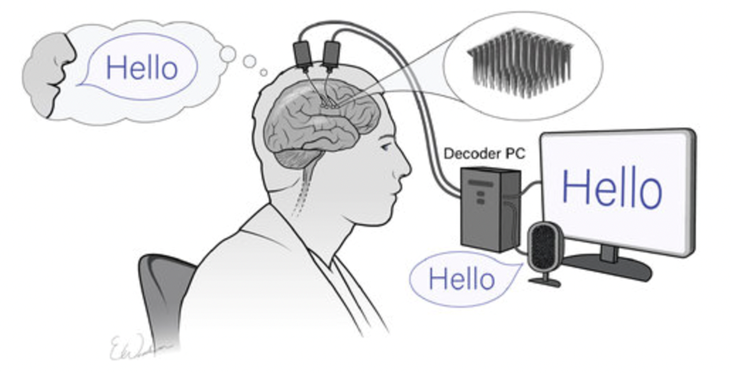 Diagram of how Braingate works, with signals saying Hello from a brain to computer