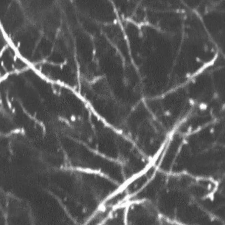 Dendritic spines