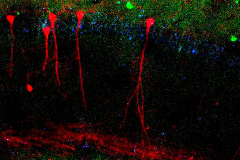Neurons in hippocampus
