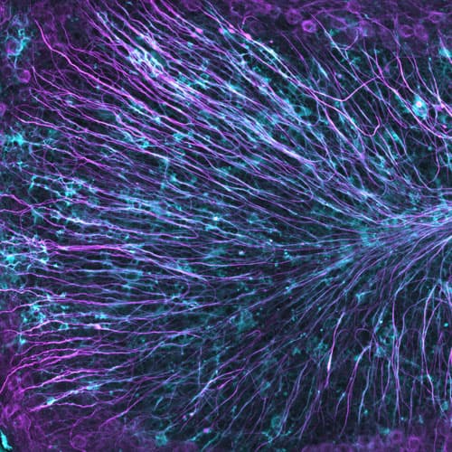 Myelin, the protective insulation around nerve fibers