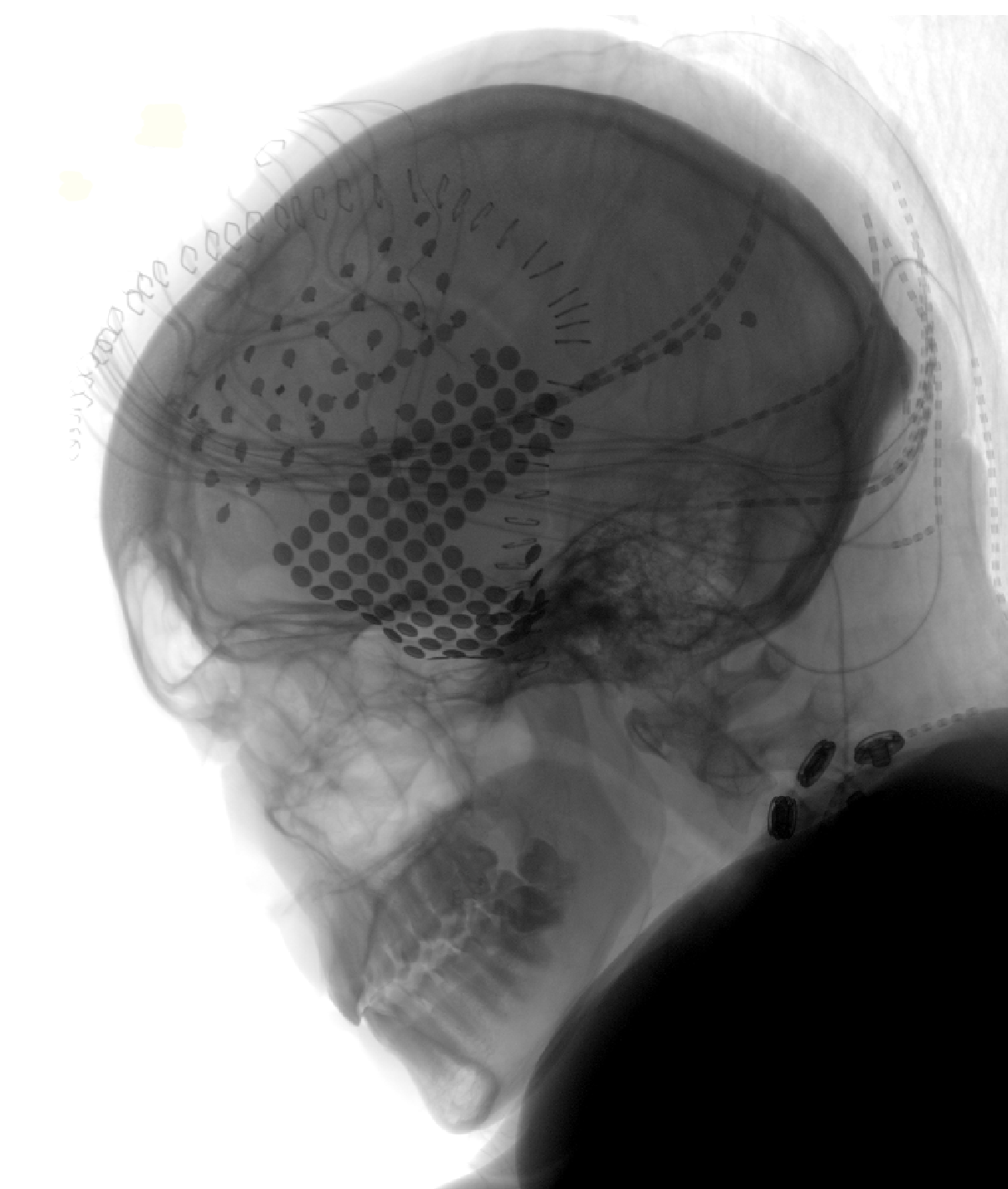 A head X-ray of a participant in the experiment