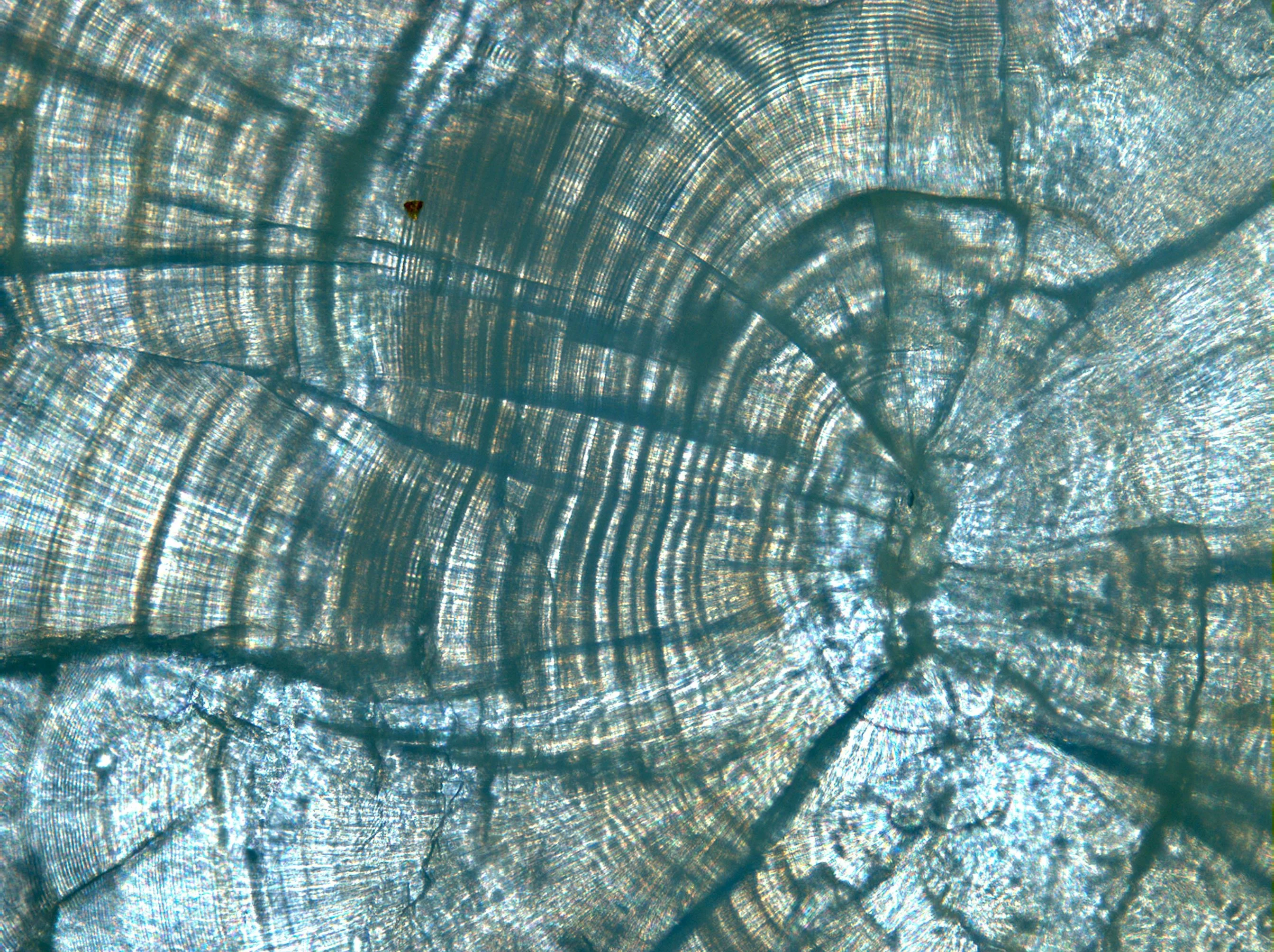 microscopic view of an otolith