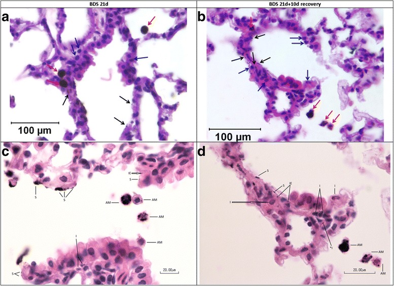 Four microscope slides showing damaged lung tissue from mice exposed to smoke