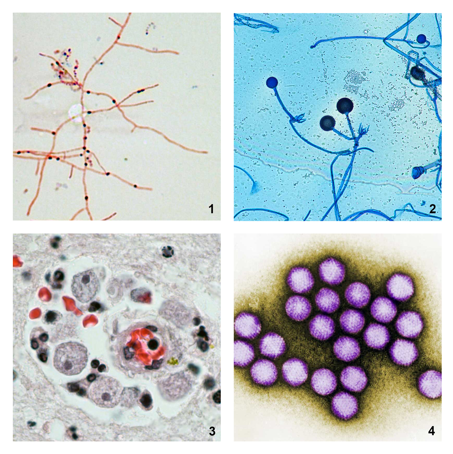 microscopic images of different types of pathogens