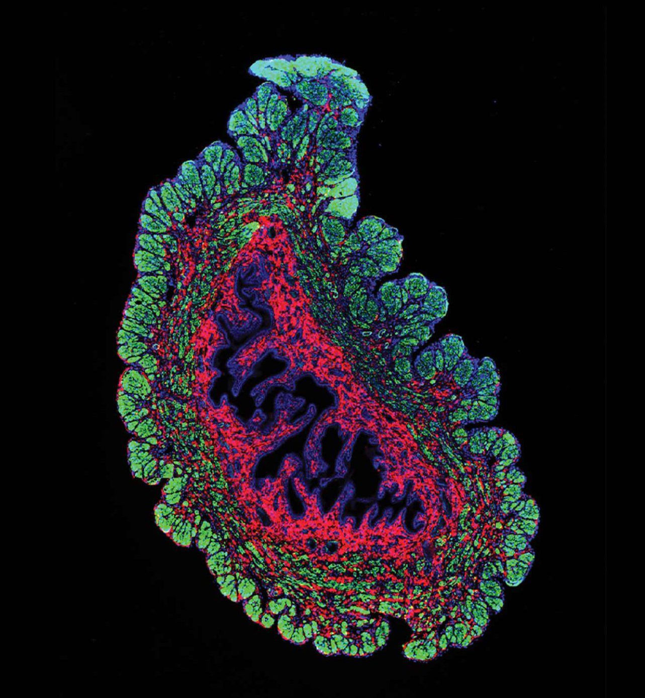 microscopic view of a uterine fibroblast cell from a mouse uterus