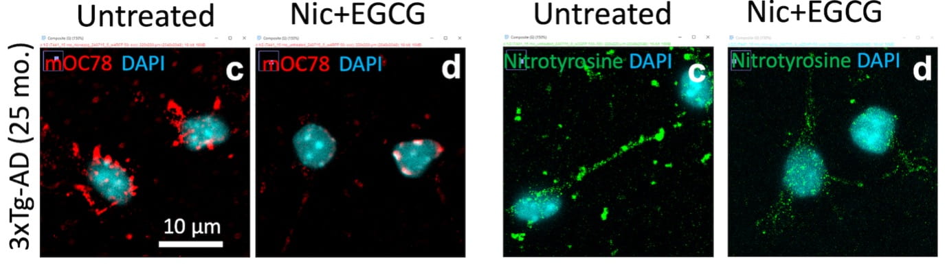 Brain imaging showing amyloid beta proteins and nitrotyrosine oxidative damage
