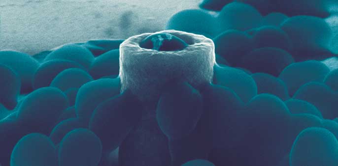 Scientists show which surfaces attract clingy Staph bacteria