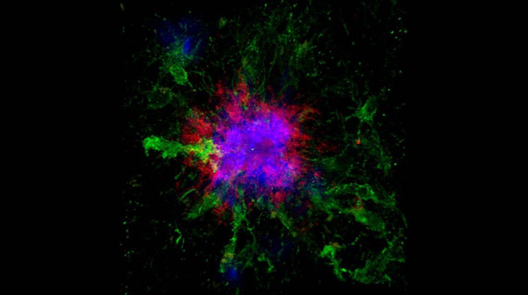 Confocal microscopy showing amyloid plaques in the brain of a mouse