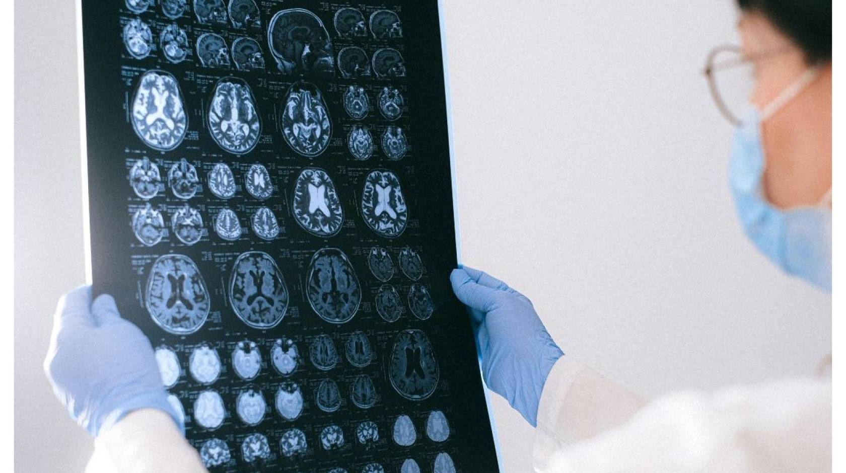 Person in lab coat, surgical mask and gloves holds a film up to a light and looks at images of brain scans on it