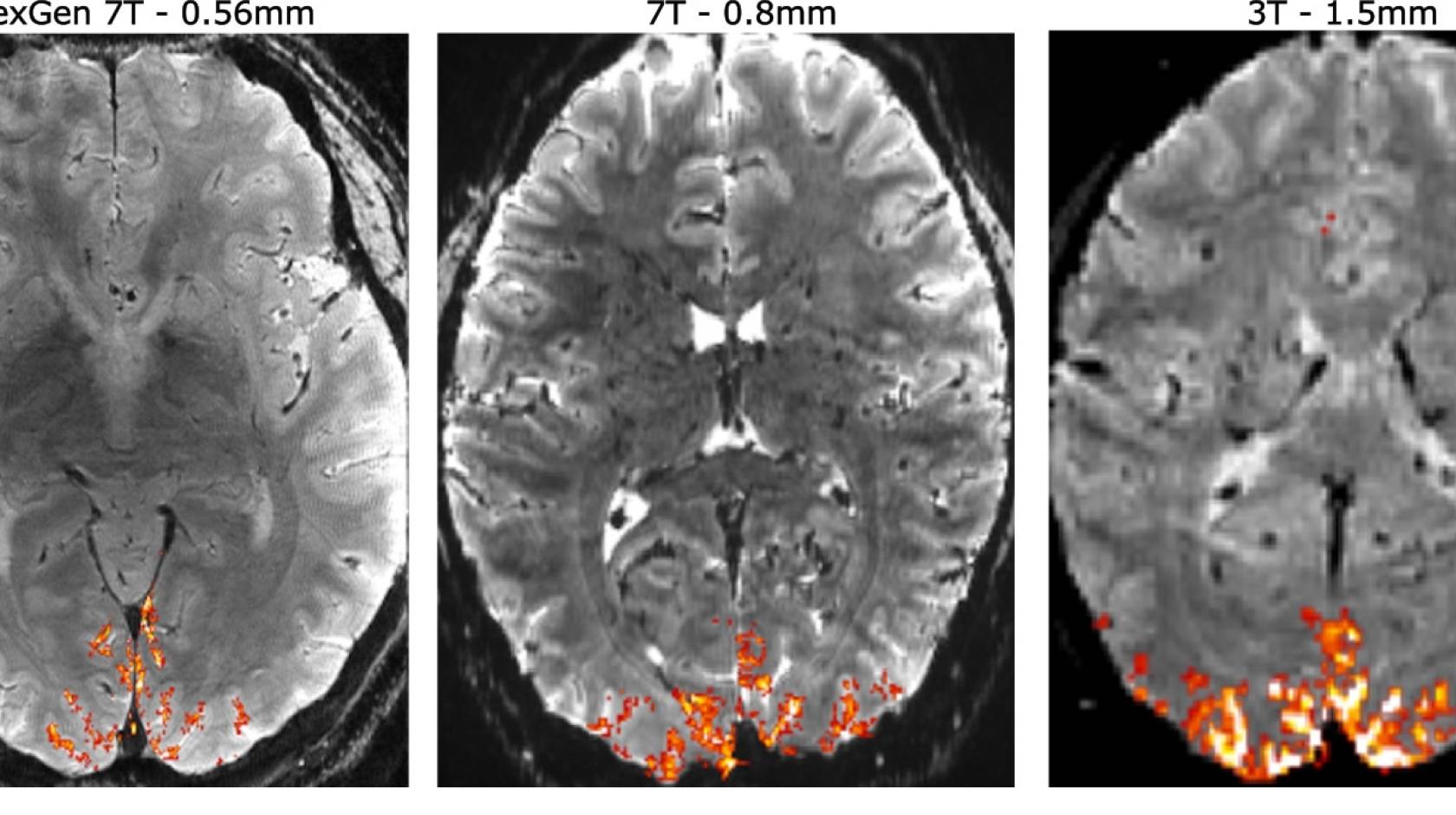 Taking the brain apart to put it all together again