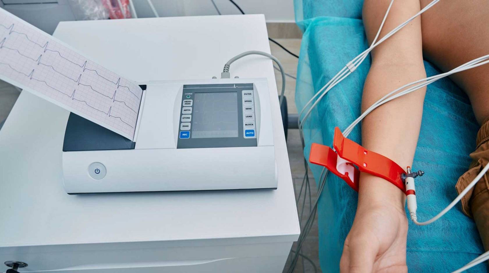 A view of someone's arm hooked up to an electrocardiogram