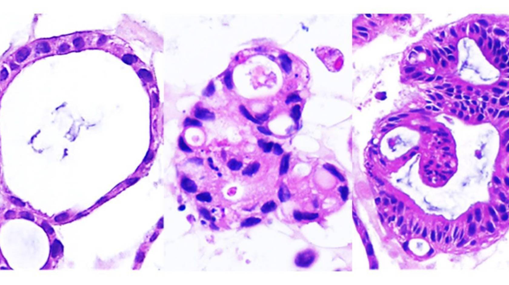 Photo of organoids, which look like purple round blobs, the one on the left is very open and least-filled in, the one on the middle is filled in, the one on the right has the thickest purple borders