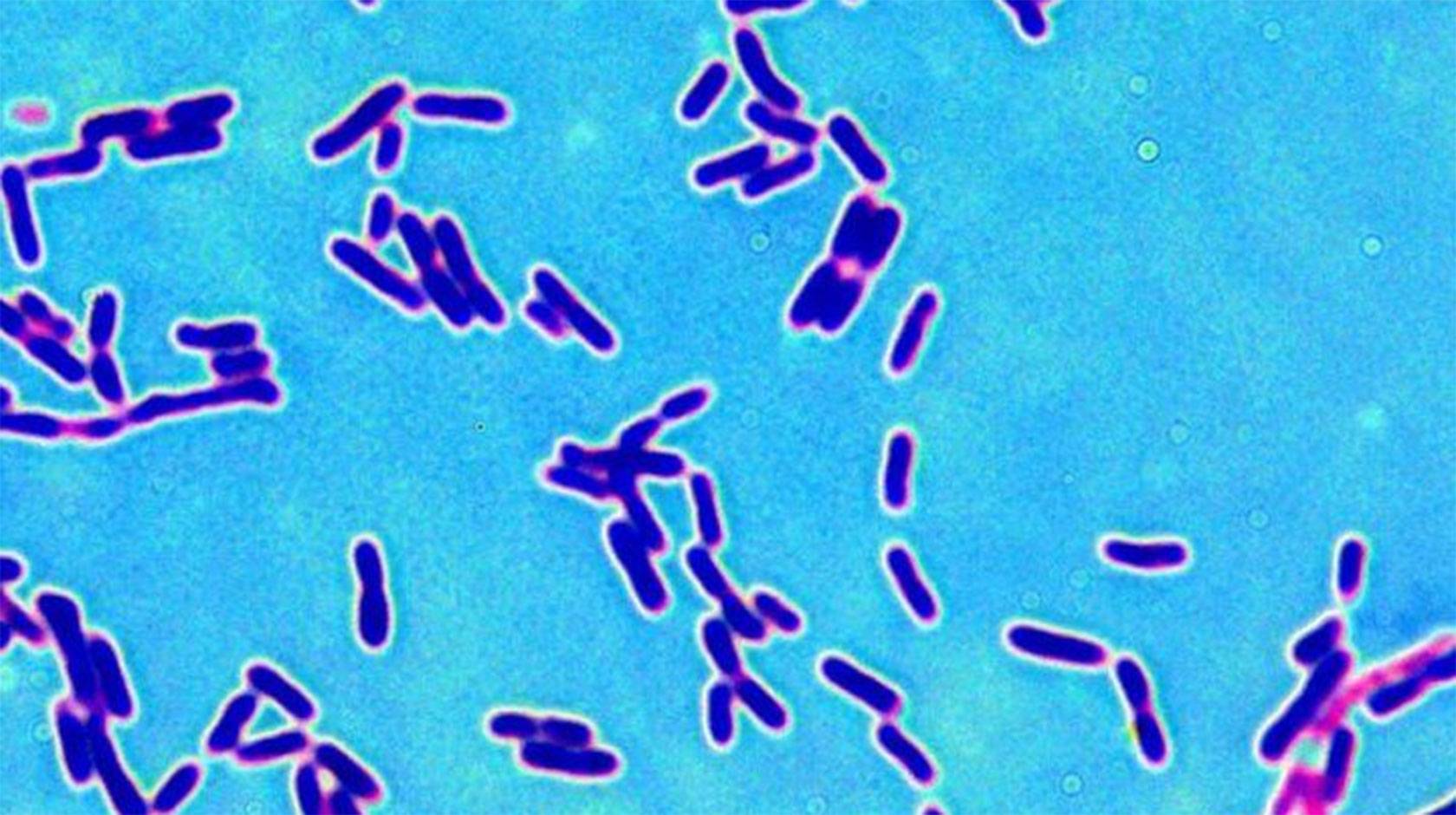 A microscopic image showing a bunch of purple cylinder-shaped bacteria on a bright teal background