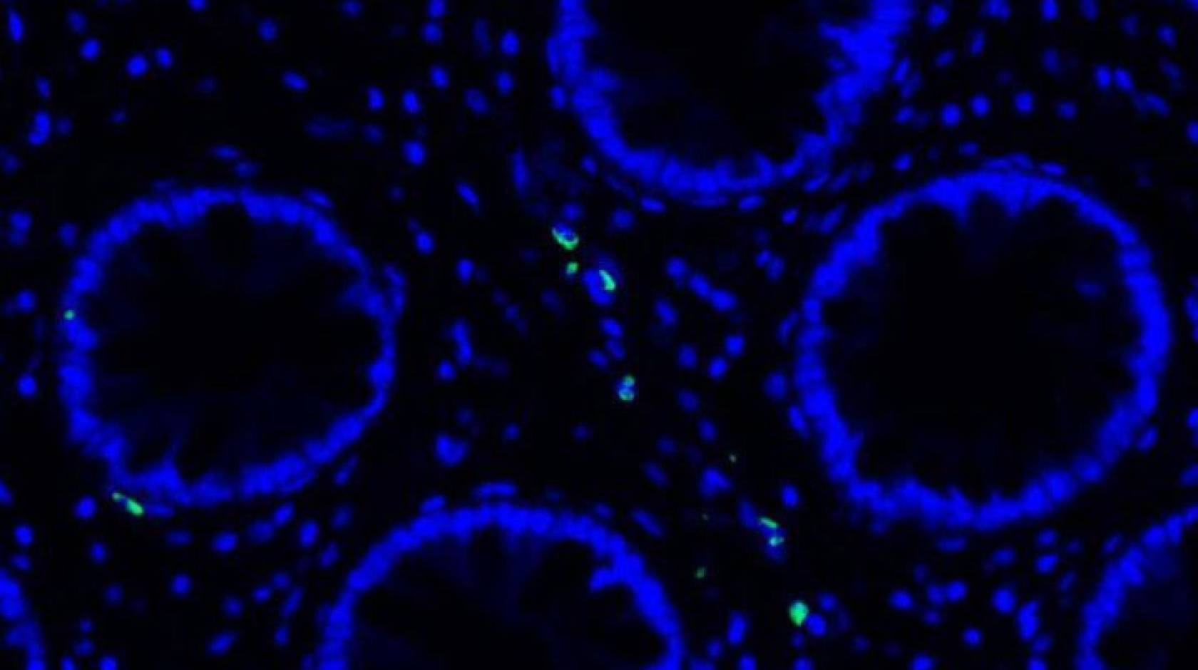 Microscope slide showing blue circles, human cells, with green dots, remnants of COVID