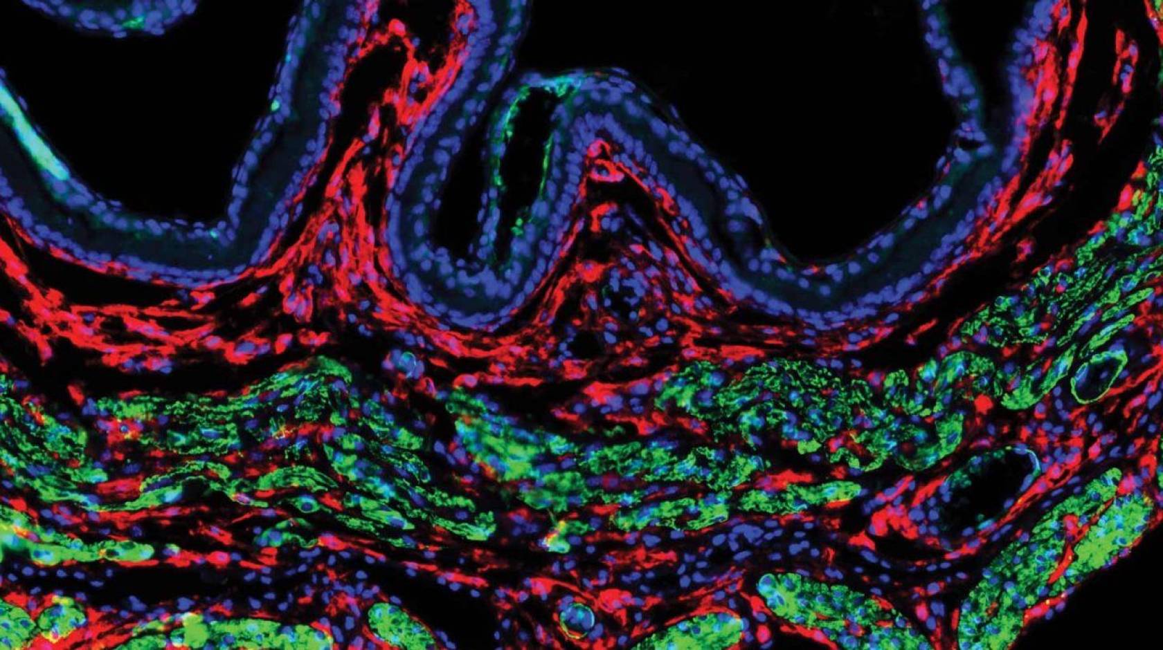 Microscopic view of uterine fibroblast cells from a mouse uterus