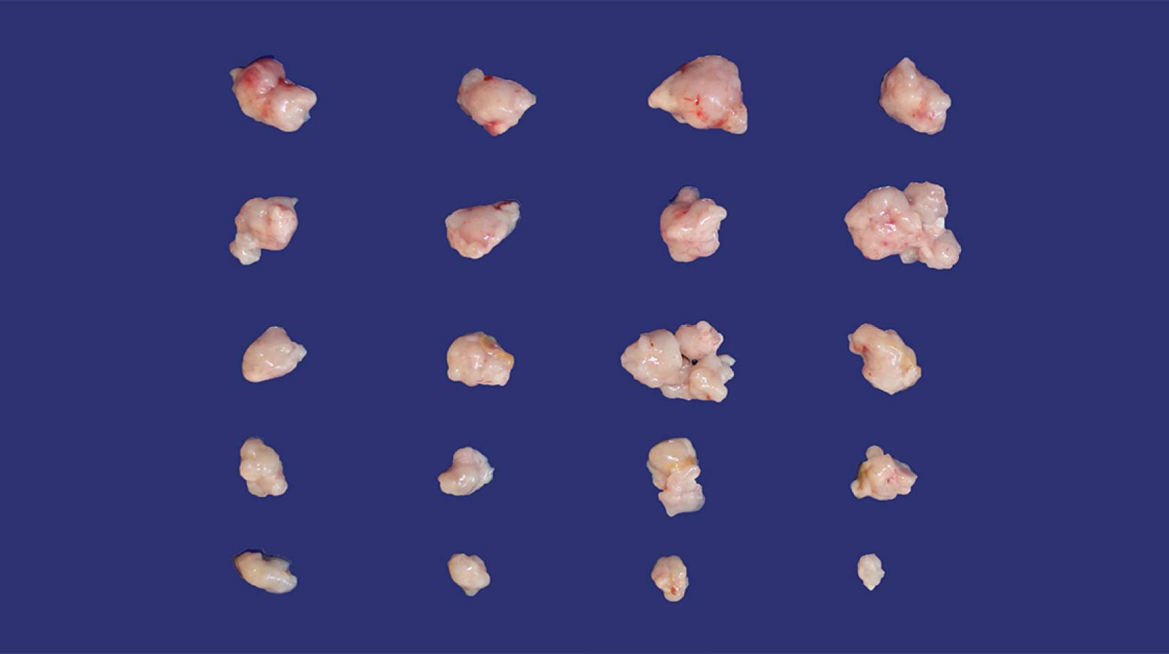 50 small tumors of different sizes, depending on how they are being treated