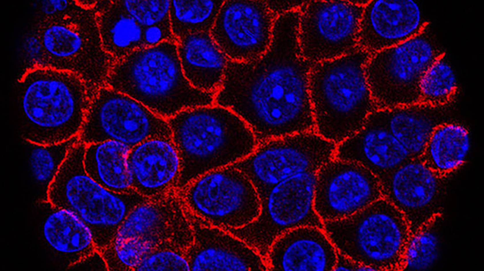 Pancreatic cancer cells