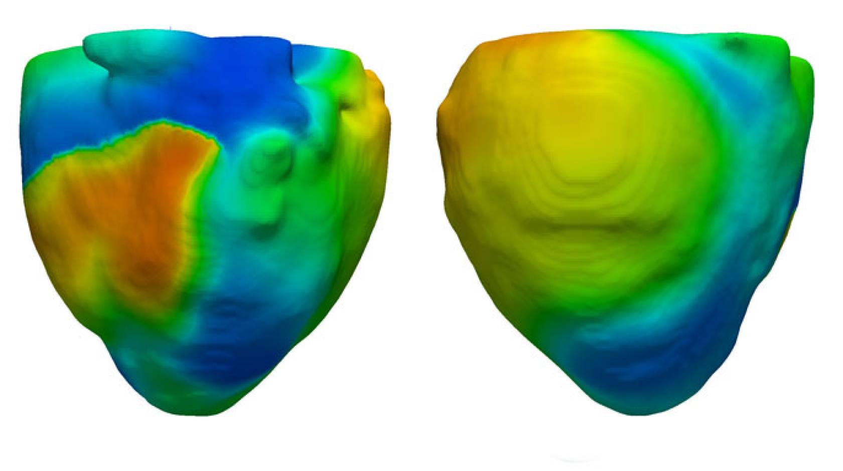 UCLA heart model