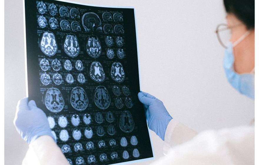 Person in lab coat, surgical mask and gloves holds a film up to a light and looks at images of brain scans on it