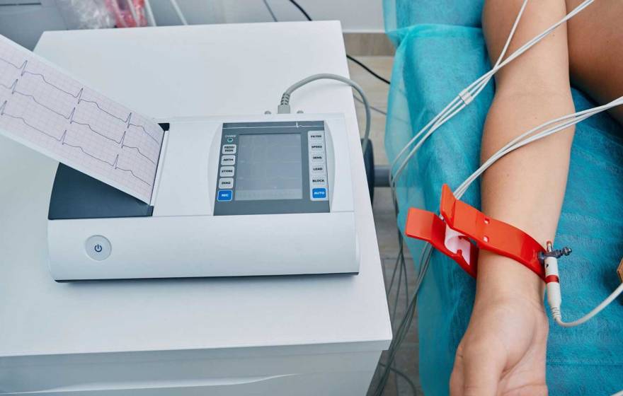 A view of someone's arm hooked up to an electrocardiogram