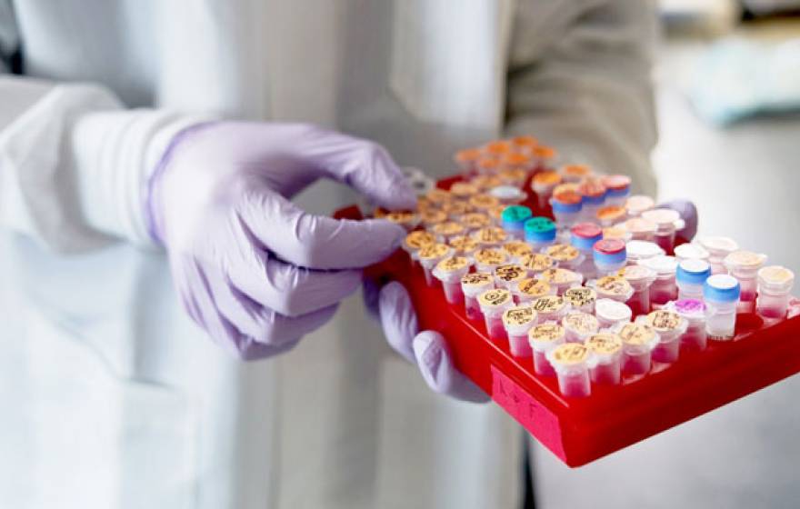 genetic testing tray UCSF