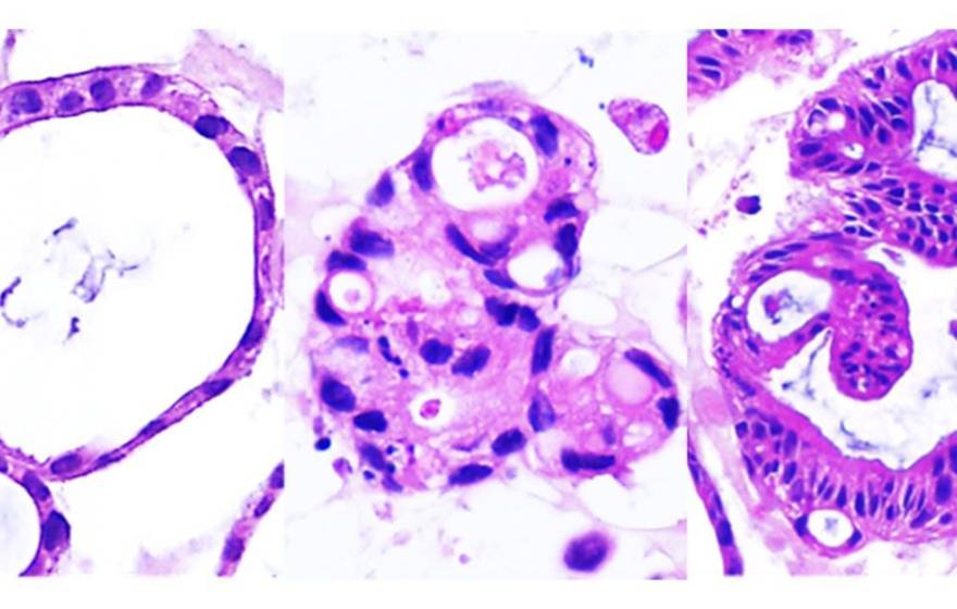 Photo of organoids, which look like purple round blobs, the one on the left is very open and least-filled in, the one on the middle is filled in, the one on the right has the thickest purple borders