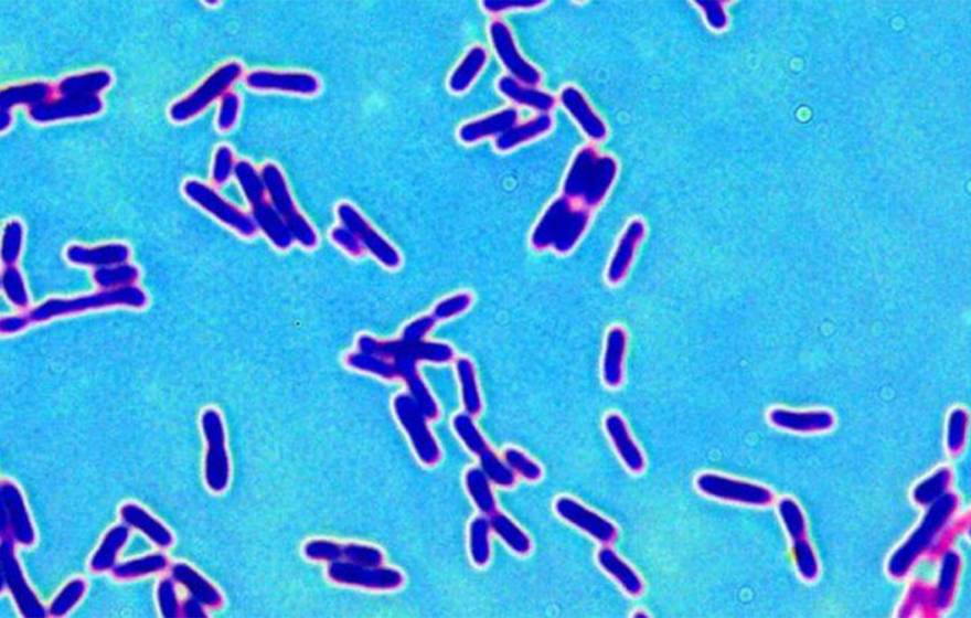 A microscopic image showing a bunch of purple cylinder-shaped bacteria on a bright teal background