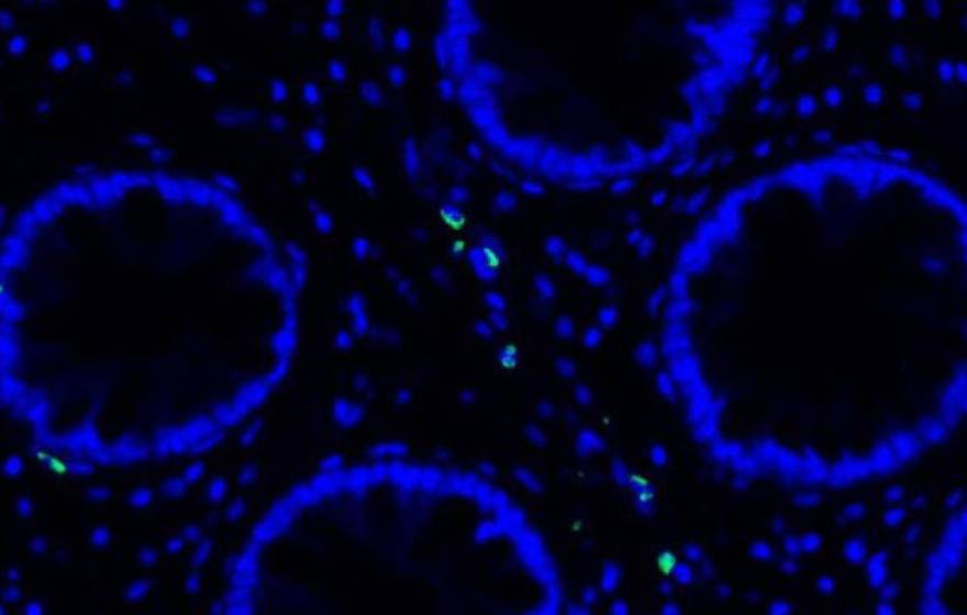 Microscope slide showing blue circles, human cells, with green dots, remnants of COVID