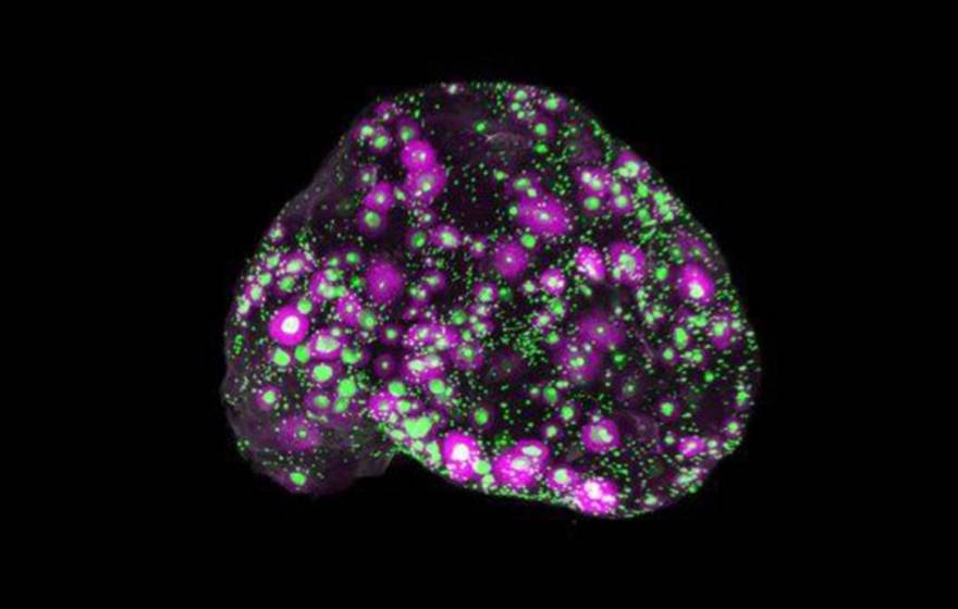 A 3D view of a whole mouse ovary, with every egg marked in green and the growing egg follicles in magenta.