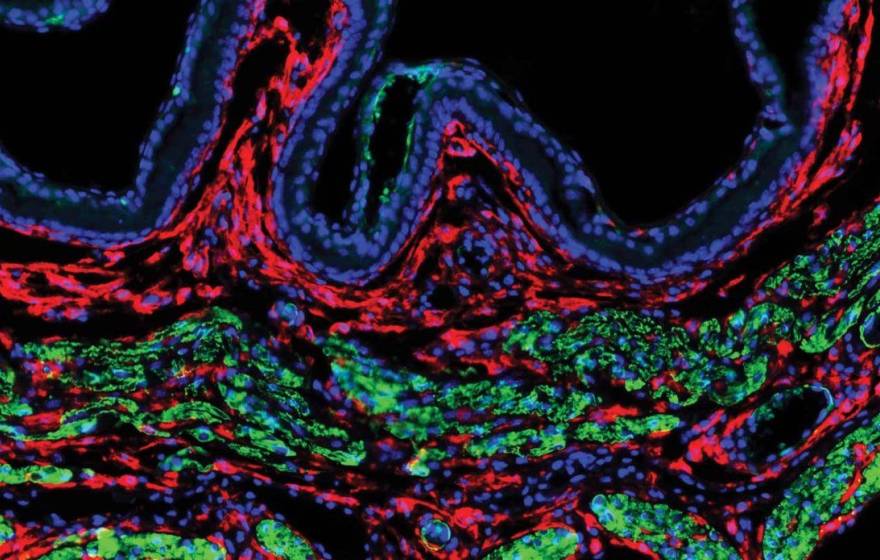 Microscopic view of uterine fibroblast cells from a mouse uterus