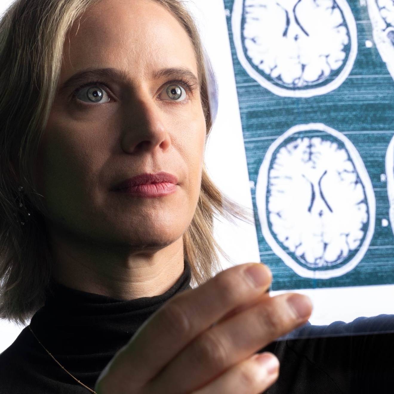 A woman holds a sheet of negatives showing scans of brains up to the light