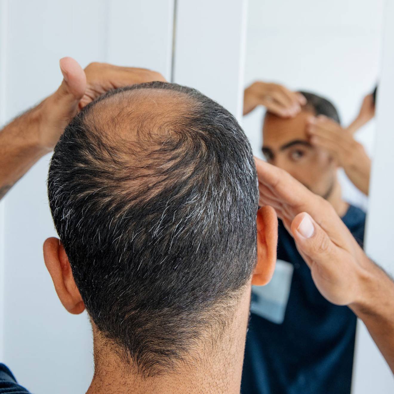 A man with thinning hair on the back and top of his head looks in the mirror, hands on his head.