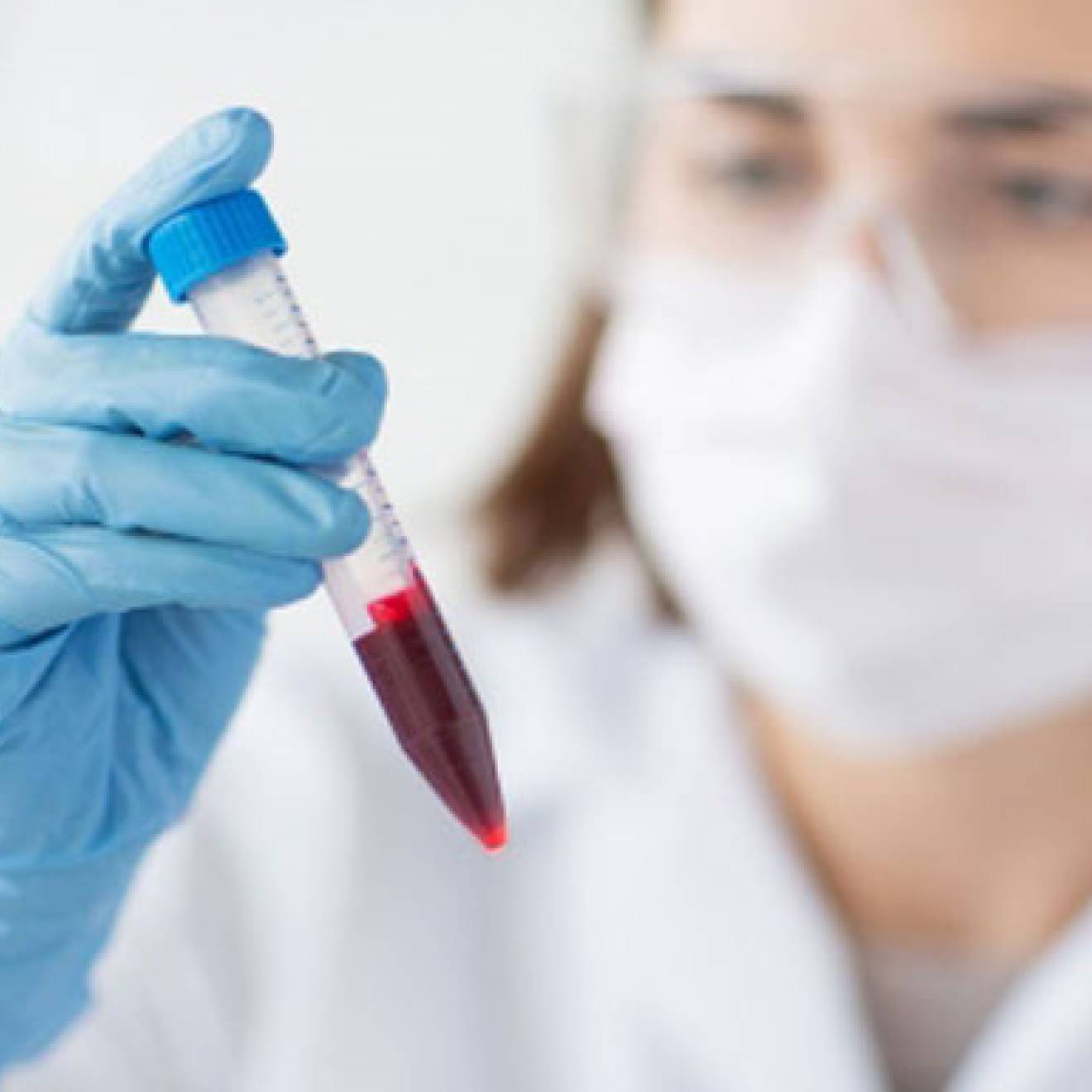 Female scientist holds blood vial