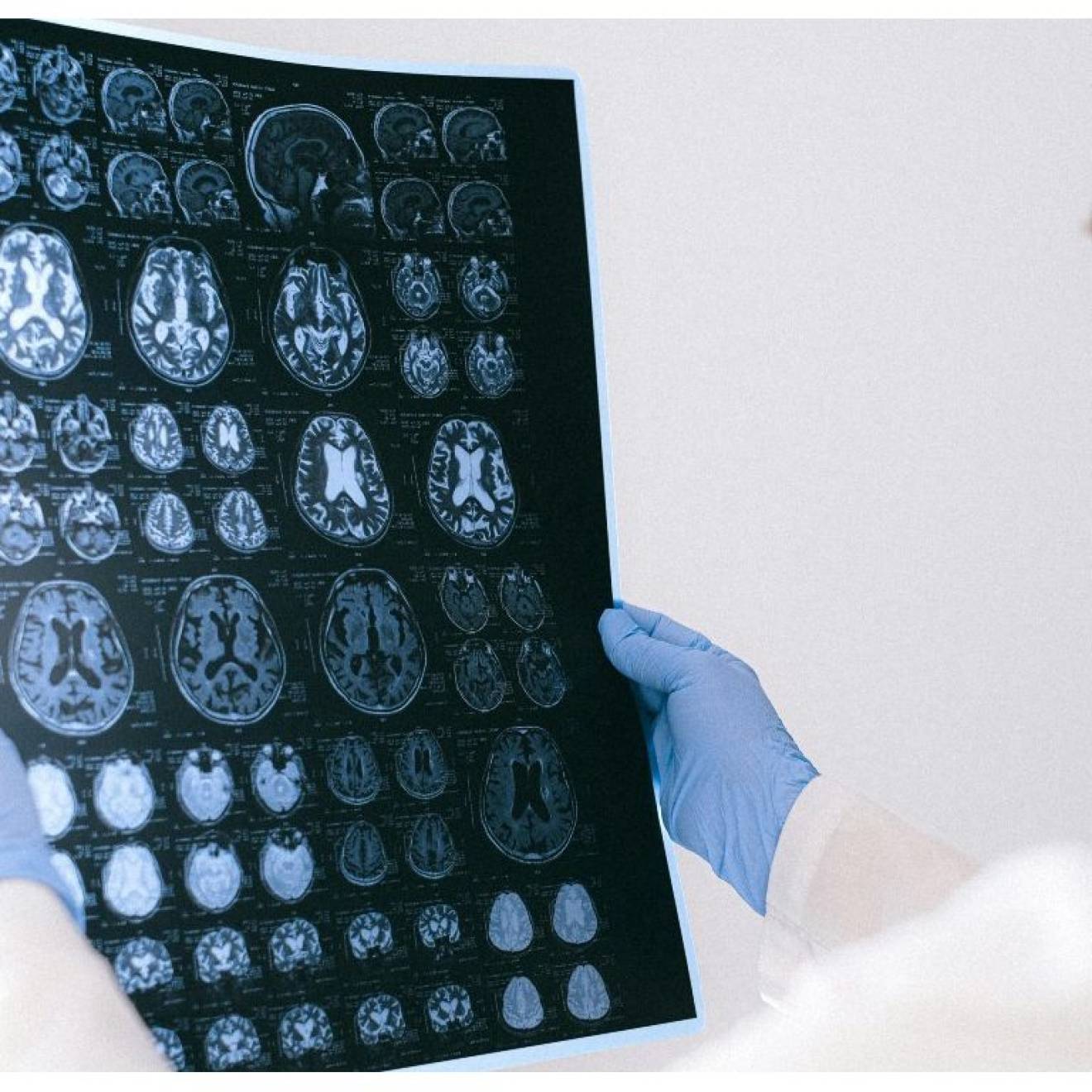 Person in lab coat, surgical mask and gloves holds a film up to a light and looks at images of brain scans on it