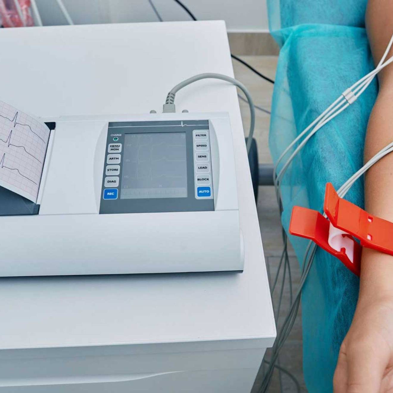 A view of someone's arm hooked up to an electrocardiogram