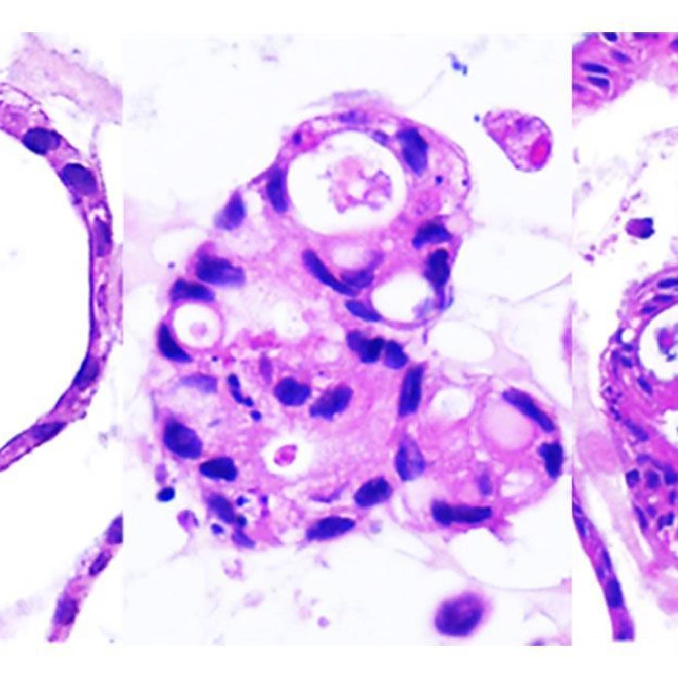 Photo of organoids, which look like purple round blobs, the one on the left is very open and least-filled in, the one on the middle is filled in, the one on the right has the thickest purple borders