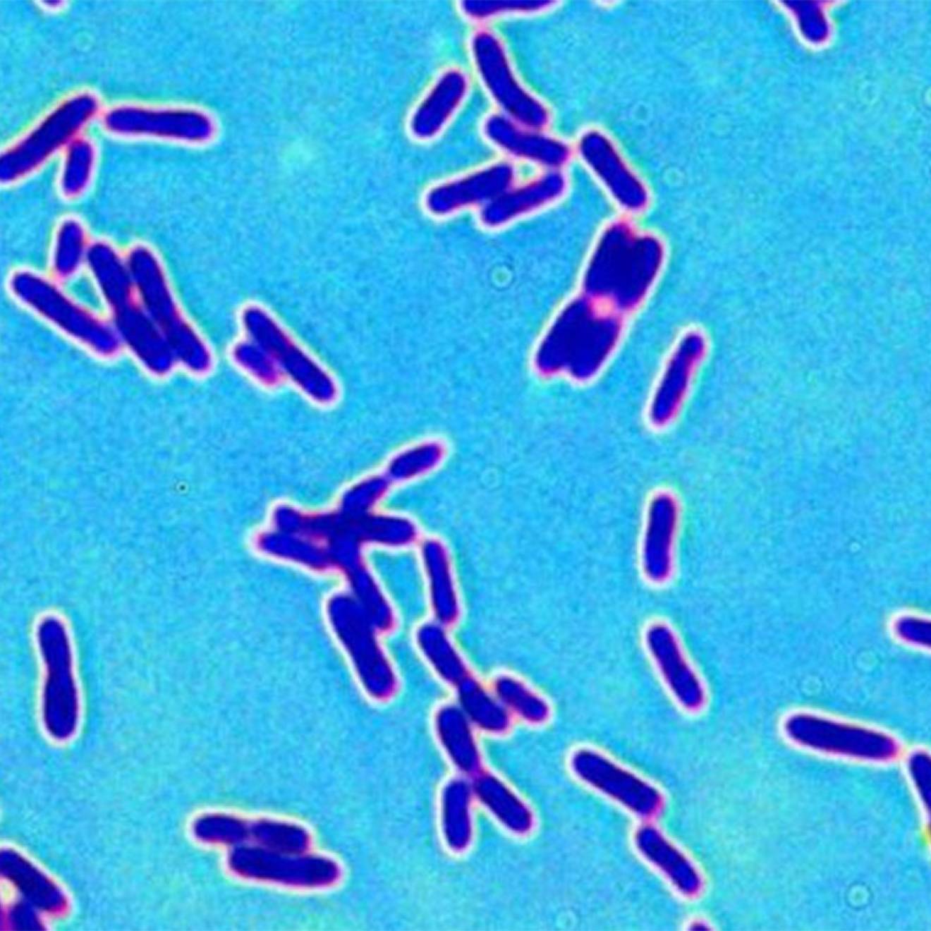 A microscopic image showing a bunch of purple cylinder-shaped bacteria on a bright teal background