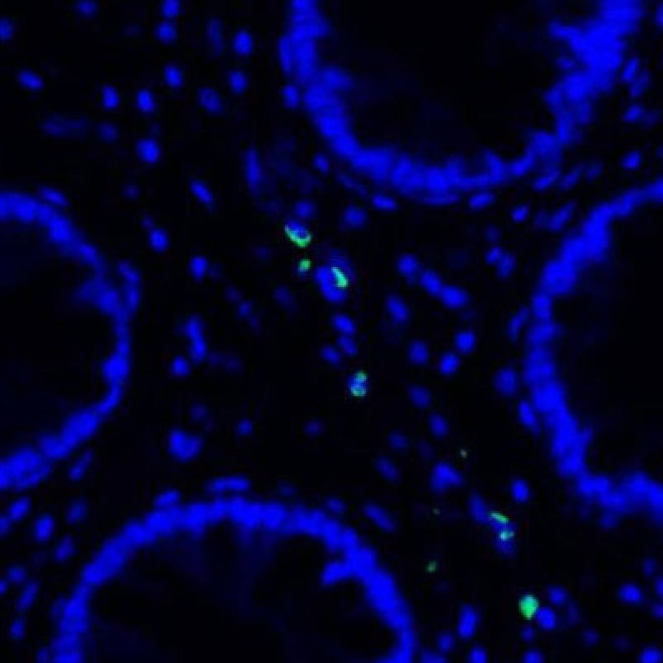 Microscope slide showing blue circles, human cells, with green dots, remnants of COVID