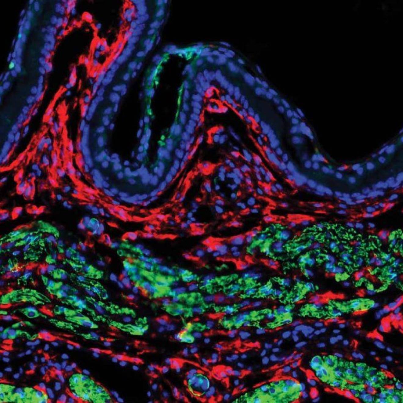 Microscopic view of uterine fibroblast cells from a mouse uterus