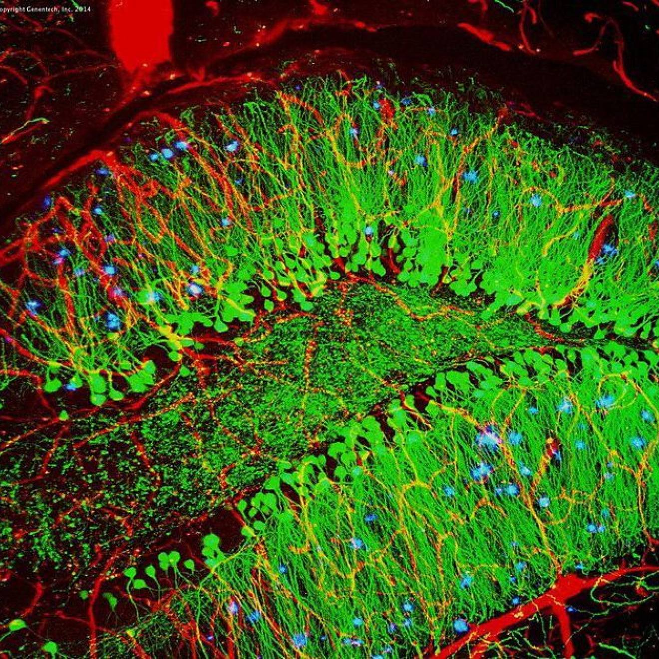 A scan of a mouse brain shows blood vessels (red), brain cells (green), and amyloid plaques (blue). A new gene therapy treatment developed by UC San Diego works by reprogramming the behavior of diseased brain cells.